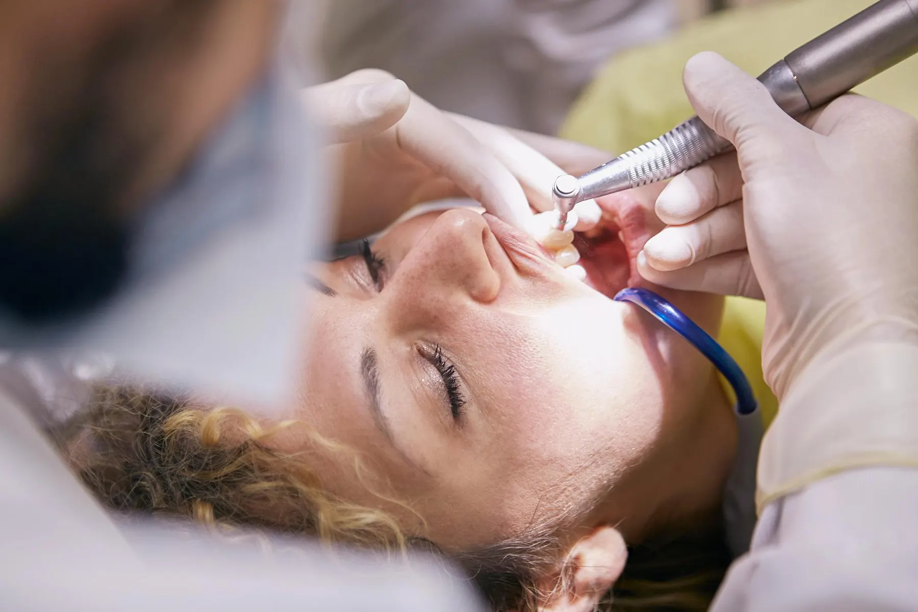 A professional dental cleaning in progress under warm operatory light